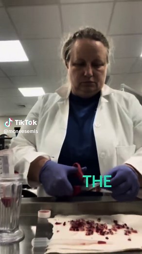 A Day in the Life of a Medical Laboratory Scientist