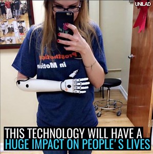 1.5M views · 5.7K shares | The process of how a bionic arm is made, amazing!  烙 | UNILAD Tech | Facebook