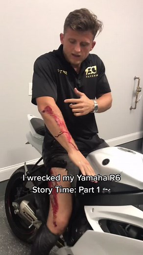 Grateful to be alive after wrecking my Yamaha R6. This is part 1. Let me know if y’all want to see the scars in a part 2? 🏍 #DailyVlog #fyp #foryou