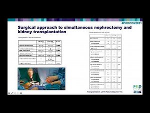 Nephrectomy surgery - understanding risks and benefits