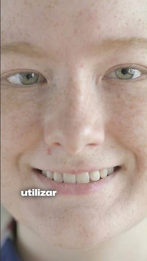 Escurecimento dos dentes pelo uso de tetraciclina