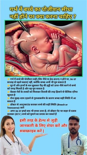 What should be done if the position of the baby in the womb is not straight? Baby Position in the...