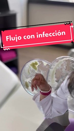 Cuidado con el color de tu flujo: Aprende sobre la salud ginecológica
