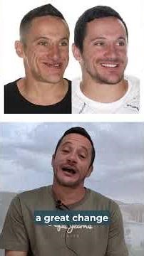 Jaw Surgery Case #176: David- Class III, Edentulism