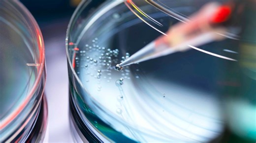 Woman's type 1 diabetes reversed with stem cell procedure in world's first