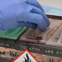 비디오: 컨포칼 현미경을 사용한 대식세포 외 트랩 시각화