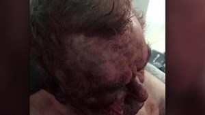 Retired prison officer bashed