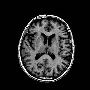 Looking at the brain with MRI