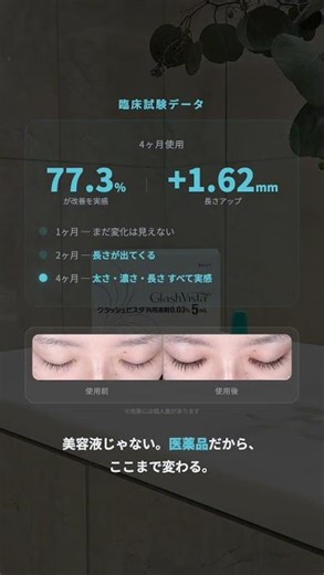 【3人に1人が悩む】減ったまつ毛が伸びる！まつ毛治療｜#グラッシュビスタ #まつ毛美容液 #睫毛貧毛症 #まつ育 #オンライン診療 #ヒルズオンライン