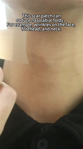 professional Silicone Scars Tape,non-irritating patch for all skin types promote Healing Easy to Tear Strong Self-Adhesive Safe Latex Free Washable for Reuse For All Ages#tiktokshop#tiktokmademebuyit#scar#Scartape #silicone