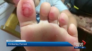 Concerns raised over Prairie Winds Park wading pool