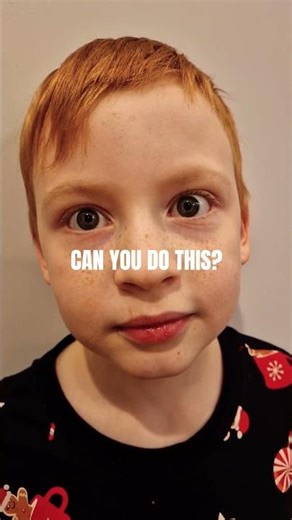 Vibrating Eyes 🧠 | Cool visual trick #science #fun