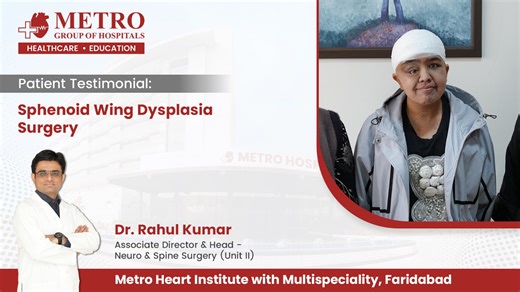 Sphenoid Wing Dysplasia is a rare and complex condition requiring expert surgical intervention. At Metro Hospital, Faridabad, our skilled neuro team, led by Dr. Rahul Kumar, Associate Director & Head – Neuro & Spine Surgery (Unit II), successfully treated a patient with this rare cranial deformity. This testimonial reflects our commitment to precision, compassion, and excellence in neurosurgical care. We’re proud to be a trusted name in advanced neurological treatments, helping patients regain t