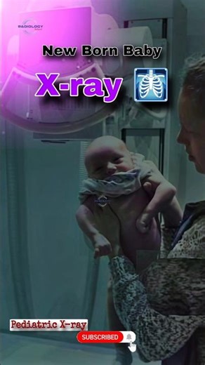 Baby X-ray #xray #xraytechnician #babyxray #education #radiologyschool #pediatricxray