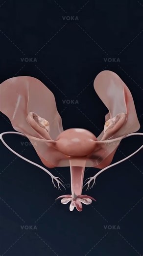 medical_animation on Instagram: "What is Cervicitis? What are the signs and symptoms? Gynecology in 3D Cervicitis is an inflammation of the cervical mucosa, affecting either the cervical canal (endocervicitis) or the vaginal portion of the cervix (exocervicitis). Here’s what you need to know: 🔻Causes: Sexually transmitted infections (e.g., chlamydia, gonorrhea) or noninfectious factors like chemical irritants, physical trauma, allergic reactions, or radiation. 🔻Symptoms: Abnormal vaginal disch