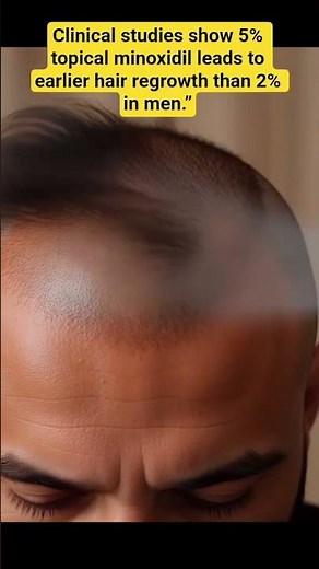 5% vs 2% Minoxidil.