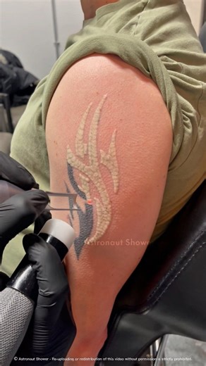 Astronaut Shower on Instagram: "Where Does Tattoo Ink Go After Laser Removal? . . . . #science #sciencefacts #reels #informative #education"