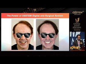 [OSSTEM MEETING 2024 TOKYO] Session1 Lecture2 (Dr.Yano)