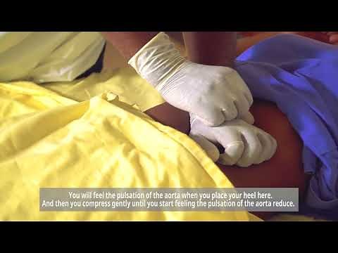 Aortic Compression in Postpartum hemorrhage management