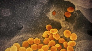 Mit Delta infiziert? Eindeutige Symptome für eine Corona-Infektion