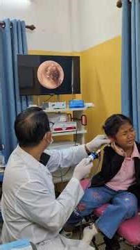 🔍 कैमरे से कान के अंदर का सच#endoscopic #earcheckup #shorts