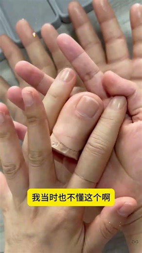 Good things to enhance confidence prosthetic finger