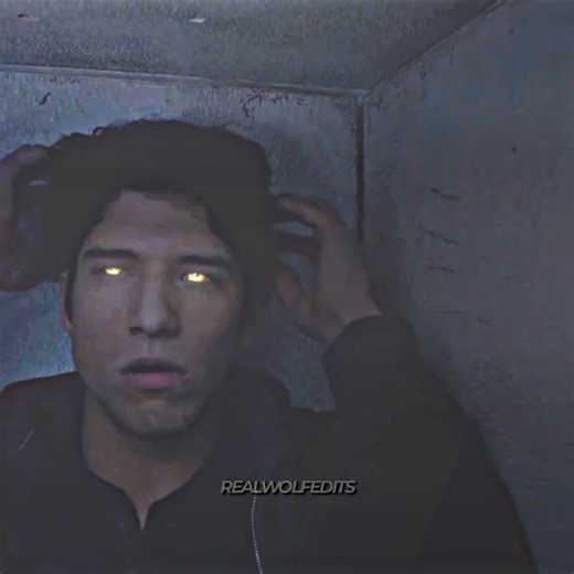 What do you think happened to Allison? 🤯🥶☠️ #teenwolfedit #teenwolf #scottmccall #viral #seriesedit