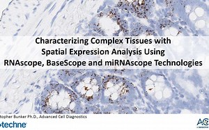 ACD Characterizing Complex Tissues with Spatial Expression Analysis Using