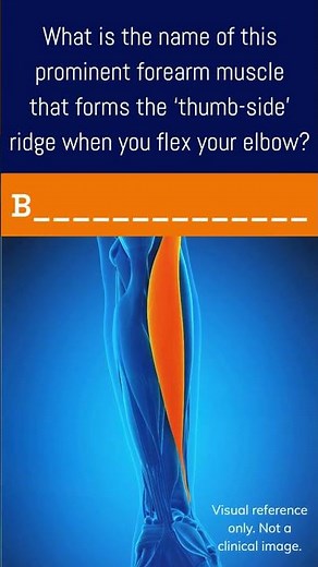 Can you name this muscle?