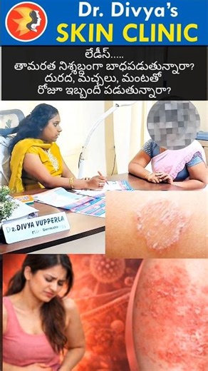 How to Cure Ringworm Permanently? | Essential Tips by Dr. Divya Dermatologist | Khammam
