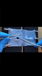 Stop Struggling! Master the Horizontal Mattress Suture FAST! #surgery #suturing #medical