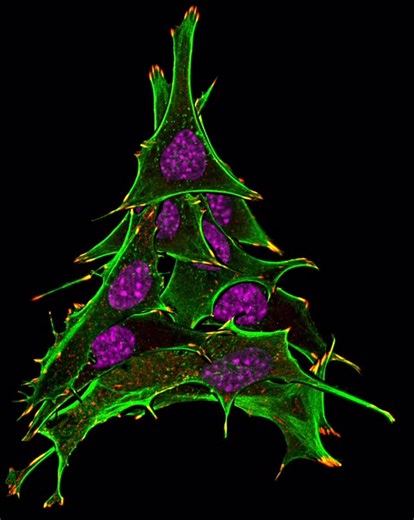 The Biomics on Instagram: "🔬🎄 A microscopic Christmas tree, created by Jamie Whitelaw 🎄🔬 This festive “tree” is built from fluorescence images of NckAP1 knockout mouse embryonic fibroblasts (MEFs) stained with Phalloidin (actin, green), DAPI (nuclei, magenta), and Vinculin (red). The images were artistically processed to form a Christmas tree composition, where actin defines the tree shape, DAPI becomes the baubles, and Vinculin serves as the Christmas lights. 🏆 Award: Winner, Scottish Micr