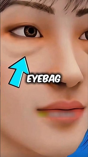 If you ever wondered why you get bags under your eyes, this is what’s really happening