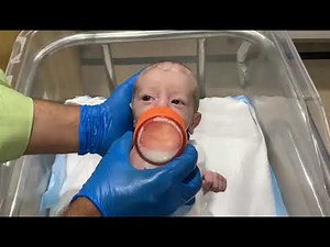 Post-Laparotomy Recovery Successful Feeding and Positive Affect