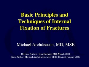 Basic Principles and Techniques of Internal Fixation of Fractures - SlideServe