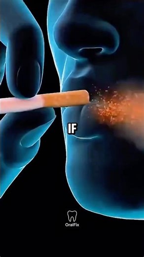Smoking Is Destroying Your Smile 🚬🦷 #oralhealth