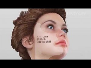 Vmax Hifu machine Installation and Operation