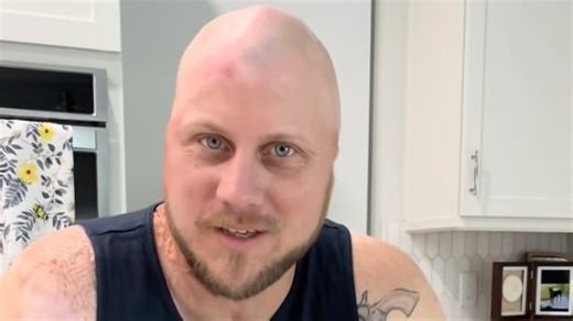 Man whose 'skull melted' after horror 4,160 volt electrocution reveals shocking injuries