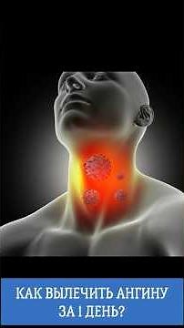 HOW TO CURE A SONSTRING IN 1 DAY? #sore throat #howtocuresore throat #health