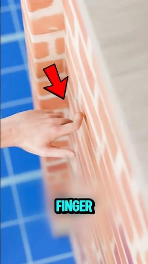 Don’t Snap It Back! The RIGHT Way to Fix a Broken Finger 😳🖐️