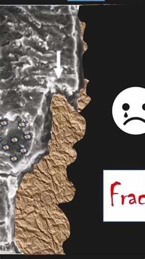 How calculus breaks itself during scaling #dentist #dentaltraining #tartar