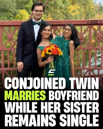 CONJOINED TWIN MARRIES BOYFRIEND WHILE HER SISTER REMAINS SINGLE. #interesting #wholesome