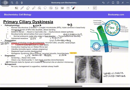 bootcamp-biochemistry-cell biology-7.primary cilliary dyskinesia理顺