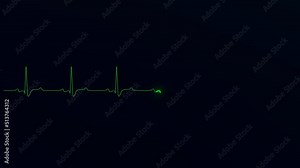 Heart cardiogram. Pulse of the ECG (electrocardiography) or cardiogram of the patient on the screen. Examination and monitoring of the heart in the hospital. 3D animation