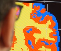 Measuring Grey Matter Differences with Voxel-based Morphometry: The Musical Brain