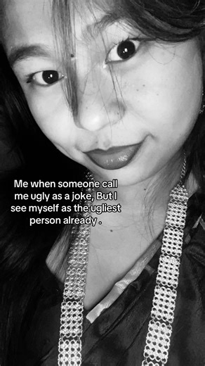 Overcoming Hurtful Comments: Embracing Self-Acceptance