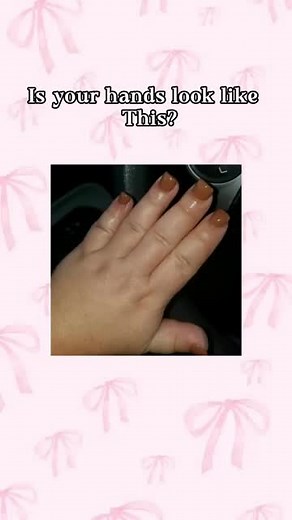 Get Slim Hands Like Kpop Idols with Effective Exercises