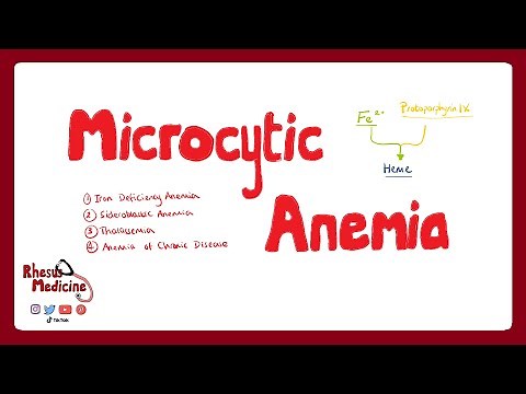 MICROCYTIC ANEMIA: Iron Deficiency Anemia, Anemia of Chronic Disease, Sideroblastic Anemia | Rhesus