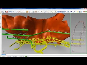 TUTORIAL SURPAC 6.2 road by cv jgs