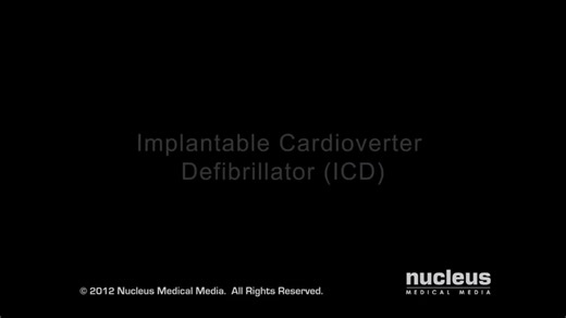 Understanding ICD Surgery and Its Life-Saving Benefits | Nucleus Medical Media posted on the topic | LinkedIn